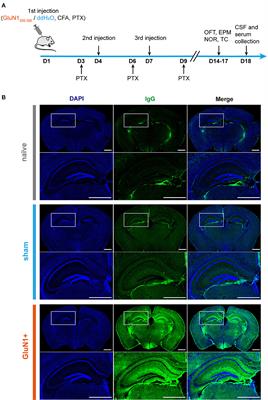 A juvenile mouse model of anti-N-methyl-D-aspartate receptor encephalitis by active immunization